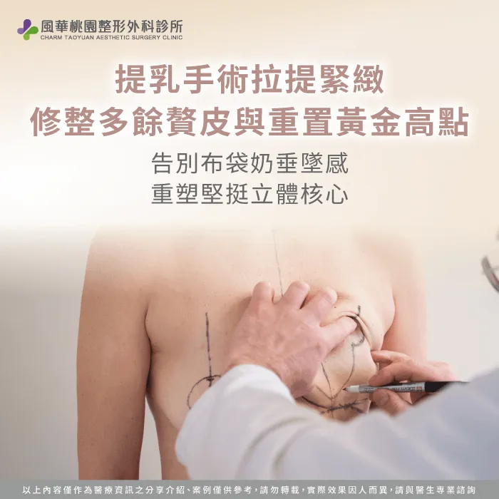 透過提乳手術拉提下垂乳腺並移回黃金中心點,徹底告別產後胸部萎縮的下垂困境。 提乳手術修除多餘鬆弛贅皮-產後胸部萎縮