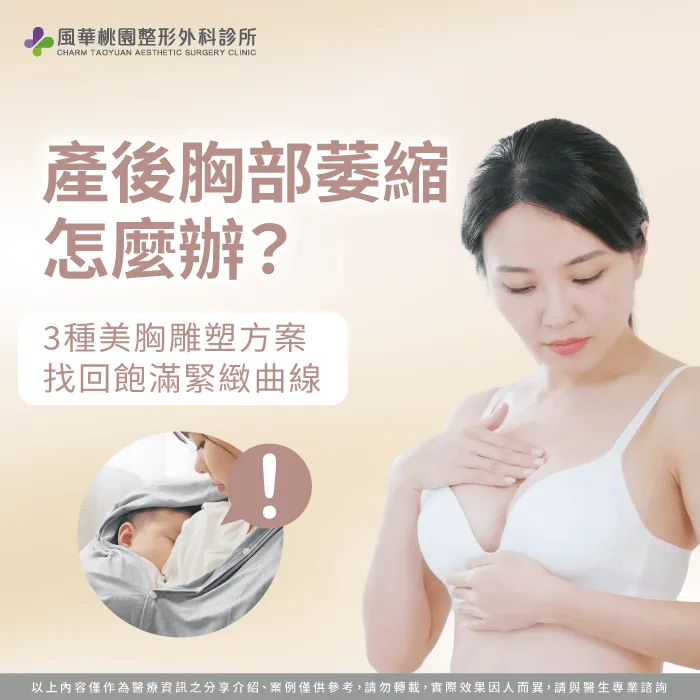 掌握產後乳腺消退原因與專業隆乳改善方案,從容解答胸部萎縮怎麼辦的困擾。 產後胸部萎縮改善與隆乳方案解析-胸部萎縮怎麼辦