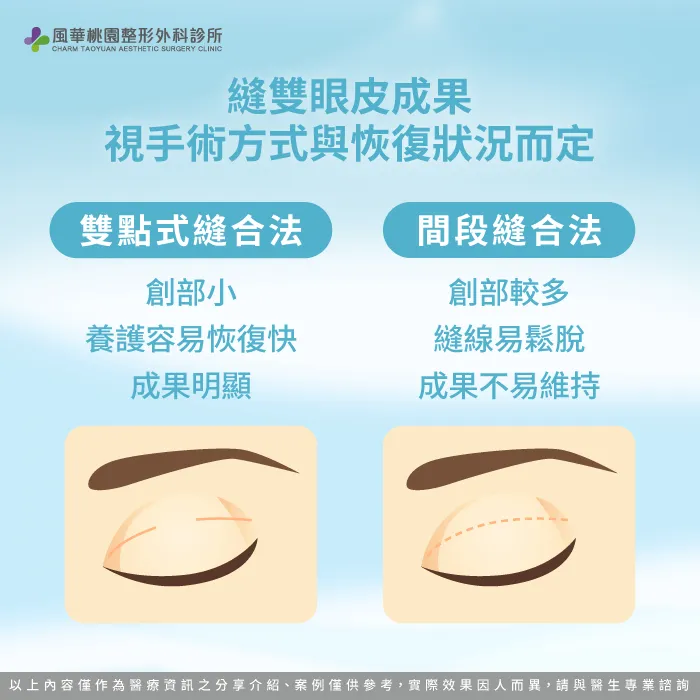 創口養護影響手術成果-縫雙眼皮恢復期