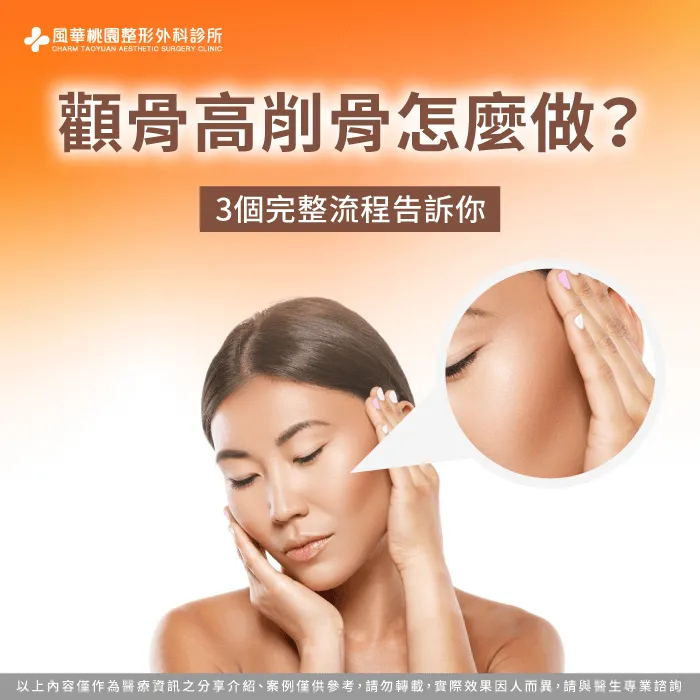 顴骨高削骨怎麼做-顴骨突出削骨