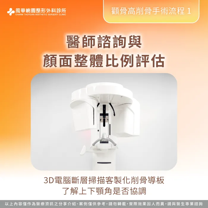 醫師諮詢與顏面比例評估-顴骨突出削骨