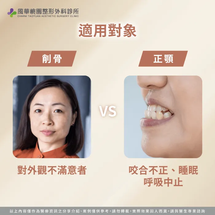 適用對象-削骨 正顎 差別
