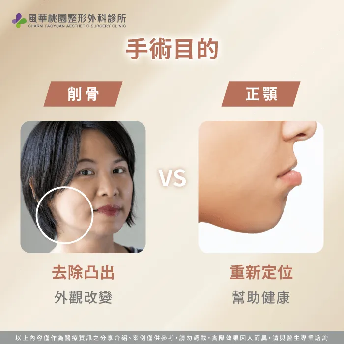 手術目的-削骨 正顎 差別