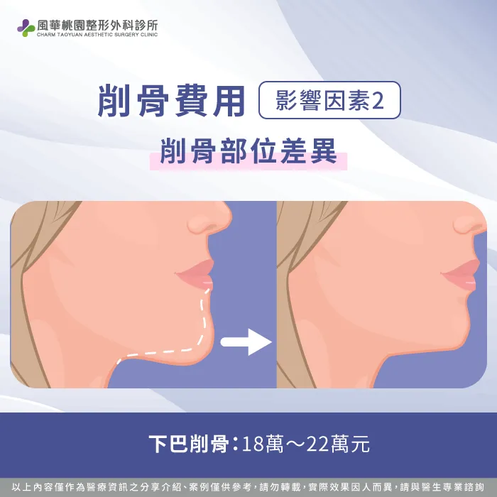 下巴削骨手術費用-削骨費用