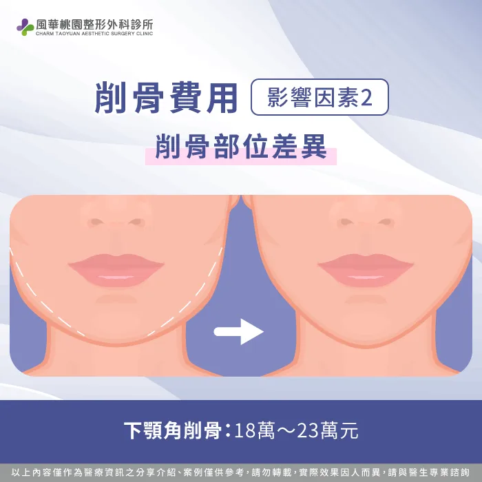 下顎角削骨手術費用-削骨多少錢
