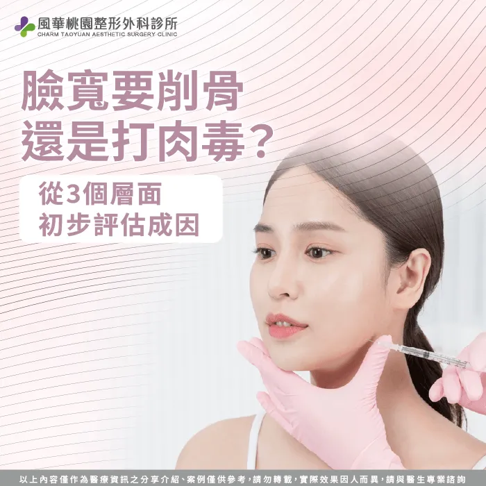 臉寬要削骨還是打肉毒？3層面評估