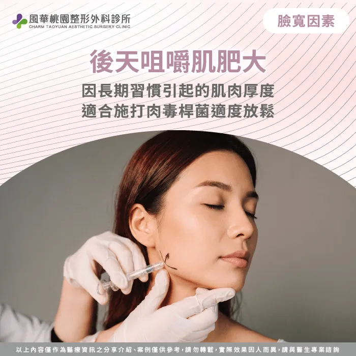 臉寬 肉毒 -桃園削骨推薦