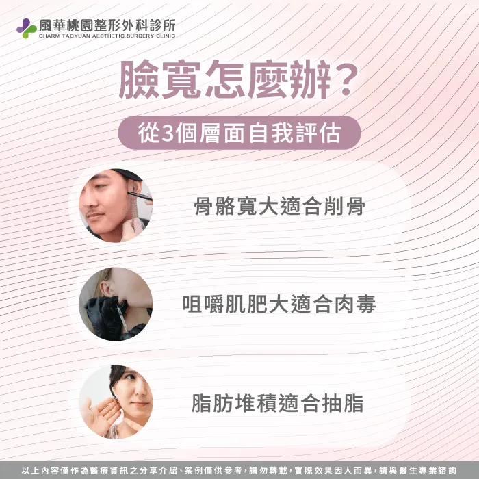 臉寬 削骨 -臉寬 肉毒
