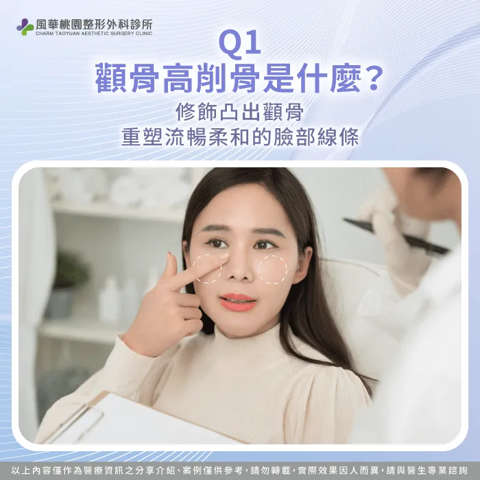 顴骨高削骨是什麼手術-顴骨高削骨