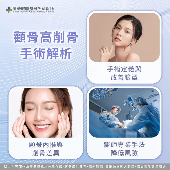 顴骨高削骨常見問題-顴骨削骨