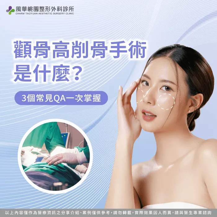 顴骨高削骨-顴骨削骨