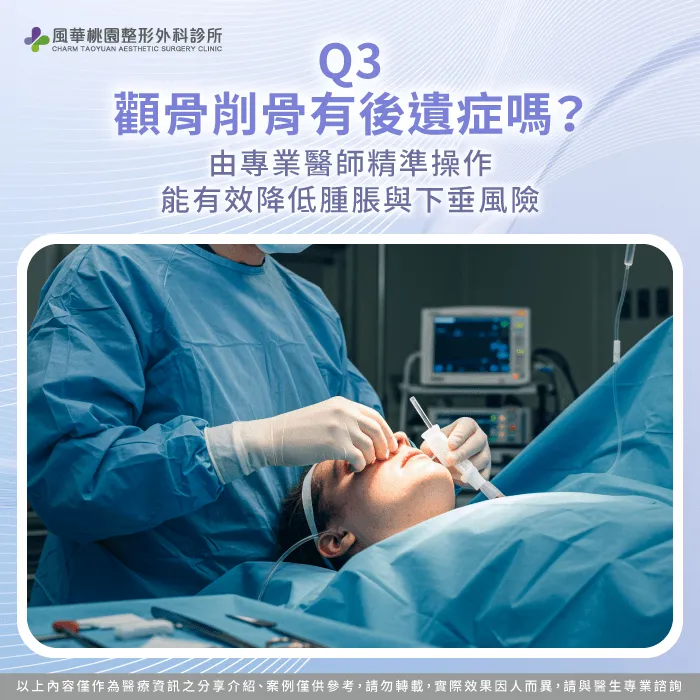 顴骨高削骨有後遺症嗎-顴骨高削骨