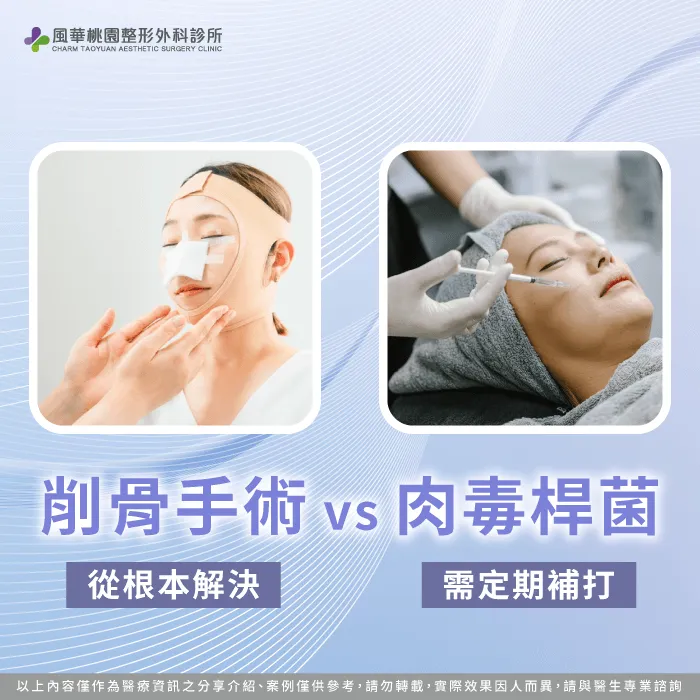 削骨手術vs肉毒桿菌-方型臉怎麼辦