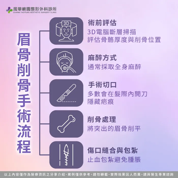 眉骨削骨手術流程-眉骨突出整形