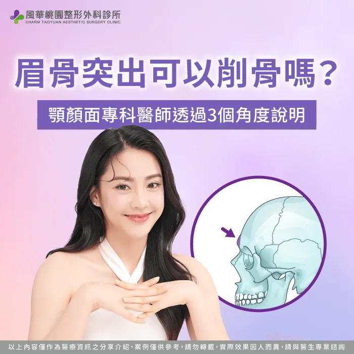 眉骨削骨-眉骨突出整形