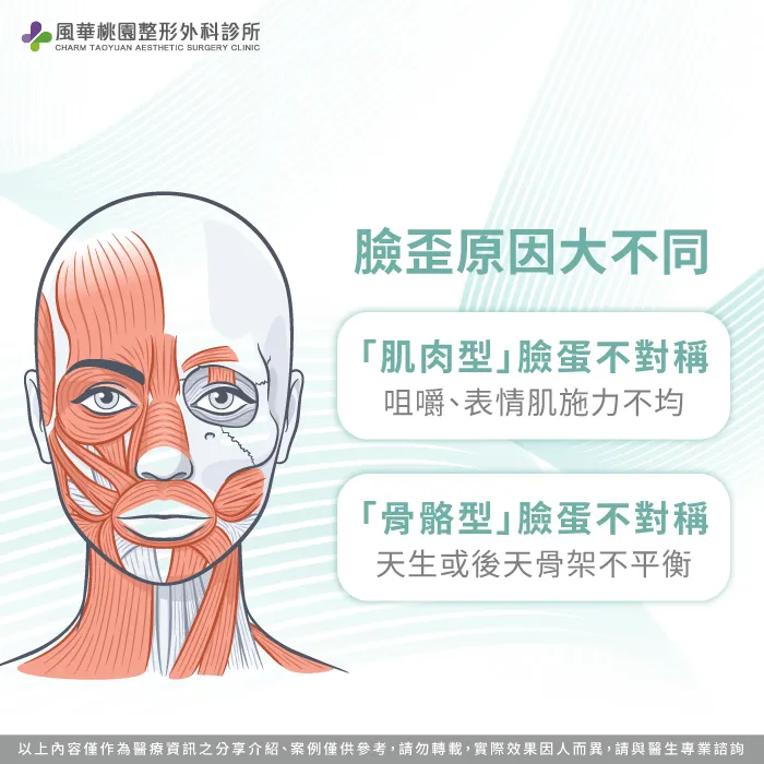為什麼臉型不對稱的2大類型與成因