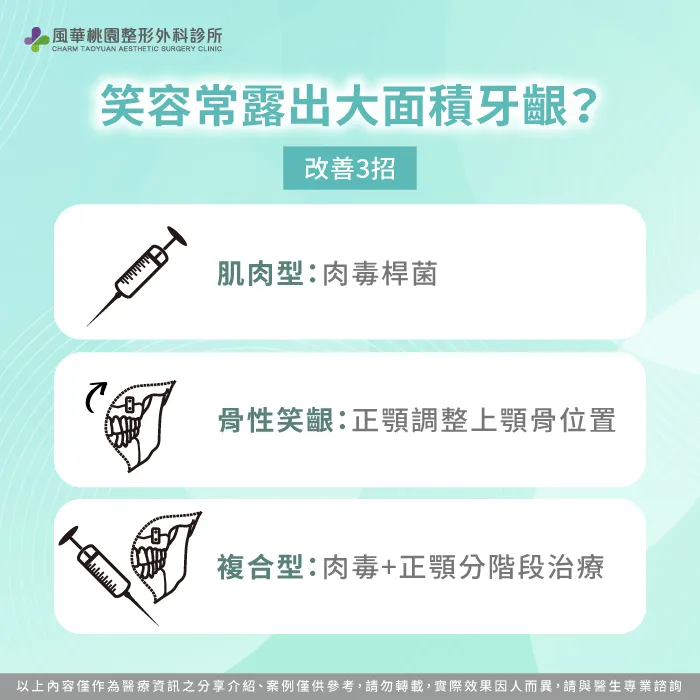 笑齦 肉毒 -笑齦 正顎