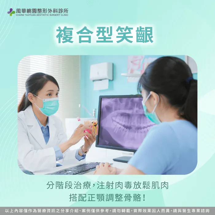 笑齦同時包含肌肉與骨性因素-笑齦 肉毒