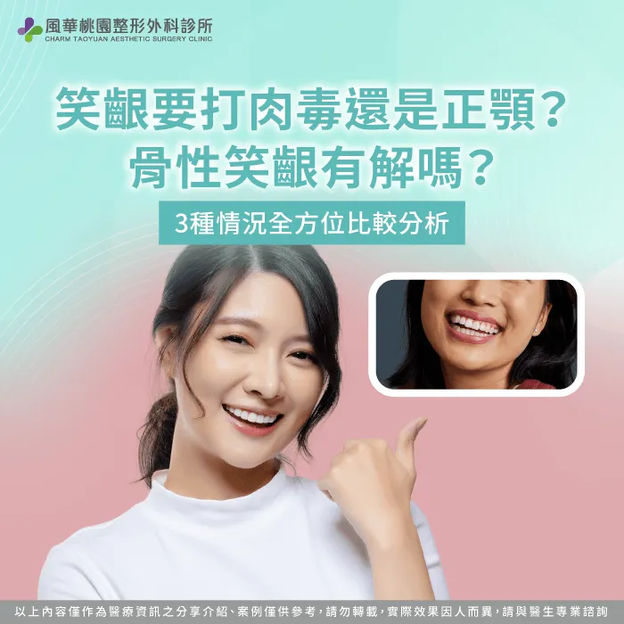 笑齦怎麼辦-桃園正顎推薦