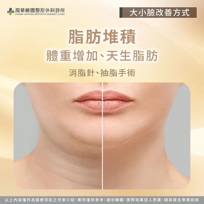 消脂針-大小臉怎麼改善