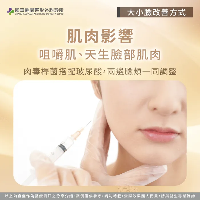 肉毒桿菌、玻尿酸-大小臉怎麼改善