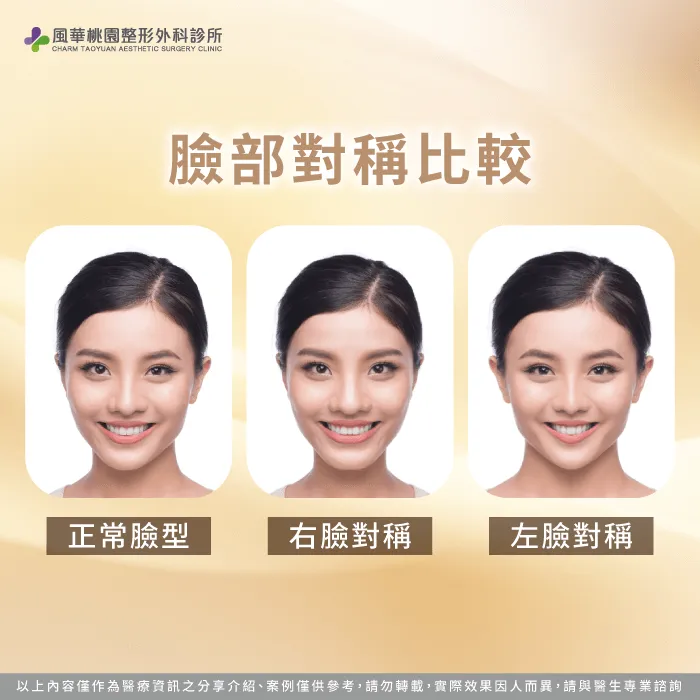 臉部對稱圖-大小臉怎麼改善