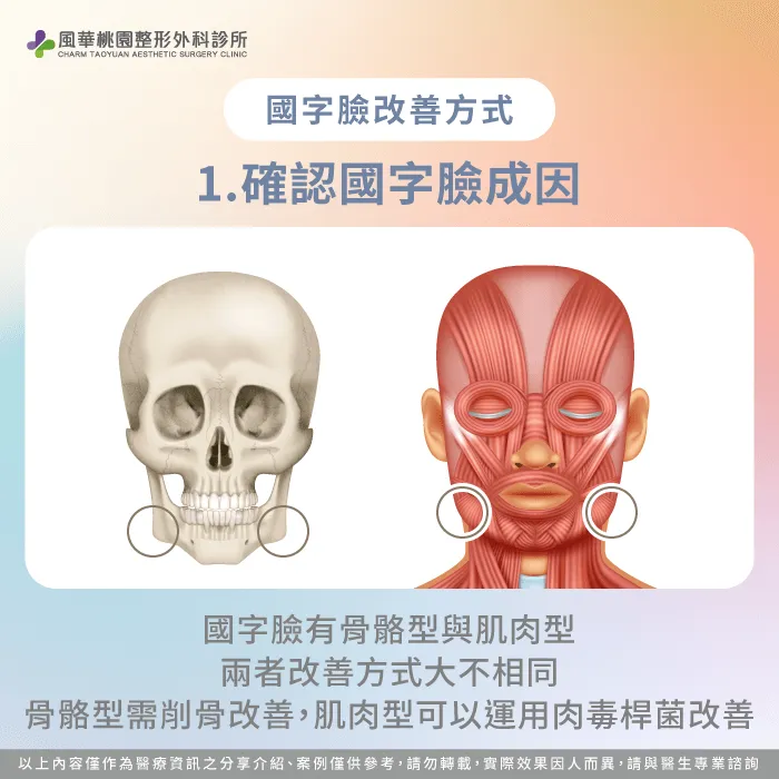確認國字臉成因-國字臉怎麼辦