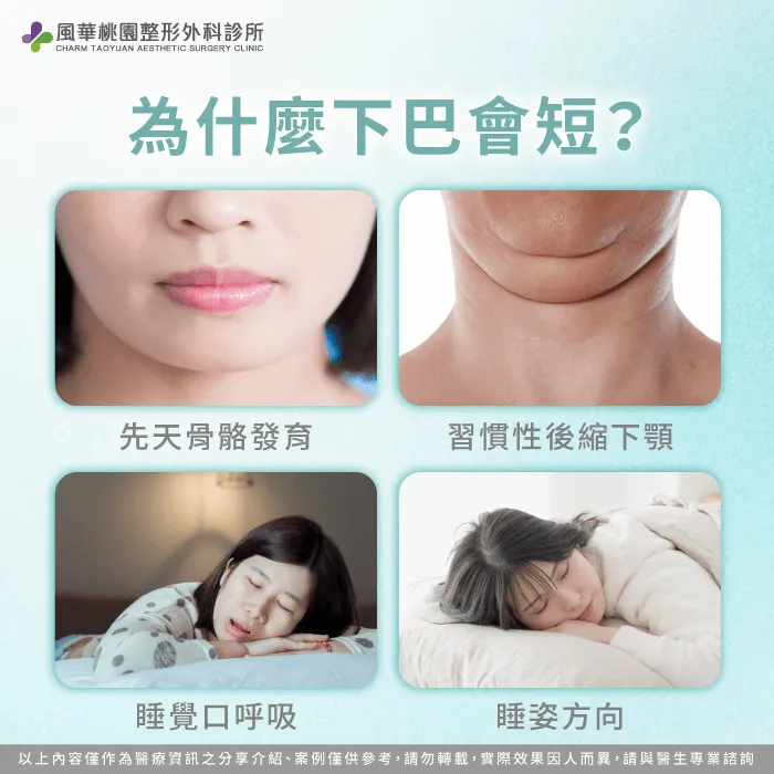 下巴過短會造成臉型不立體,使五官比例失衡、輪廓線條不明顯 為什麼會下巴短-下巴短怎麼辦