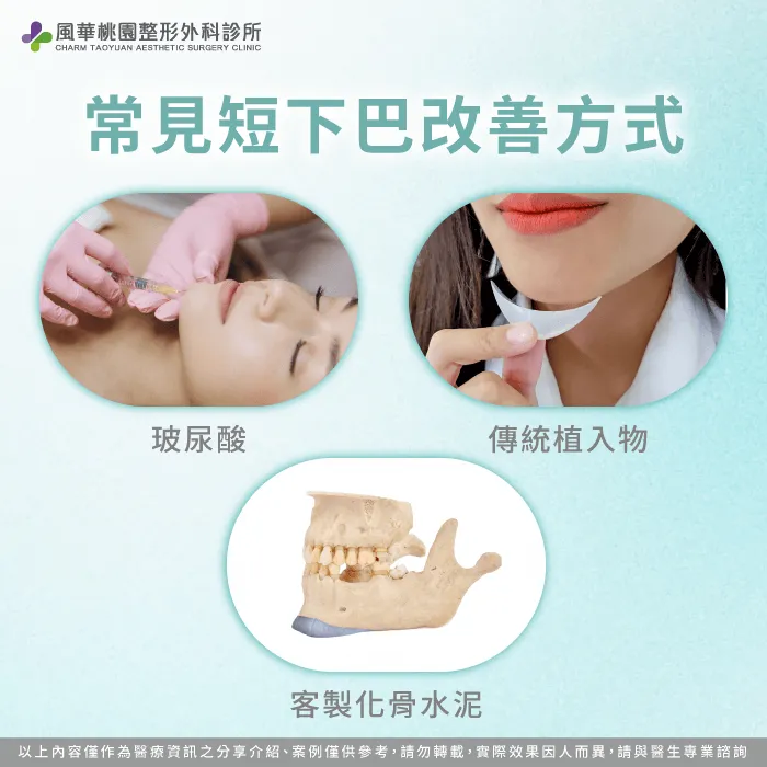 骨水泥能精準雕塑下巴長度與形狀,打造自然線條並提升臉部立體感 下巴短常見改善方式-下巴短怎麼辦