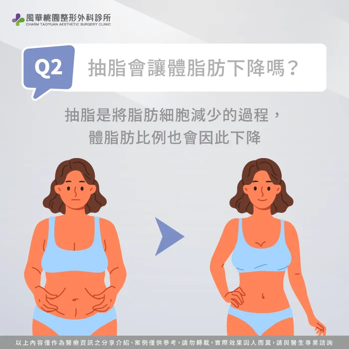 抽脂會讓體脂肪下降嗎-抽脂體脂肪會下降嗎