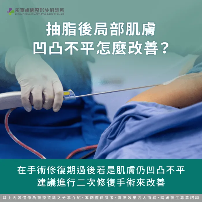 凹凸不平的解決方式-抽脂後凹凸不平