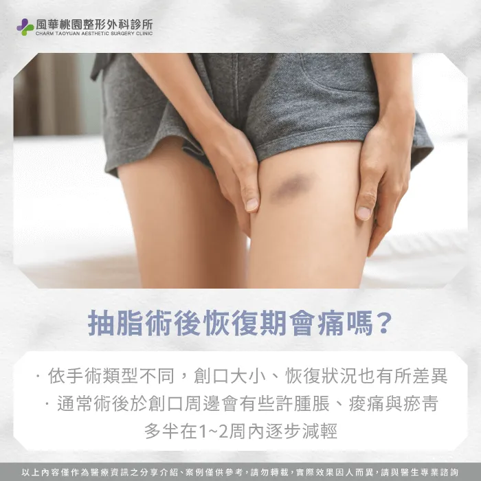 抽脂手術後會痛嗎-抽脂會痛嗎
