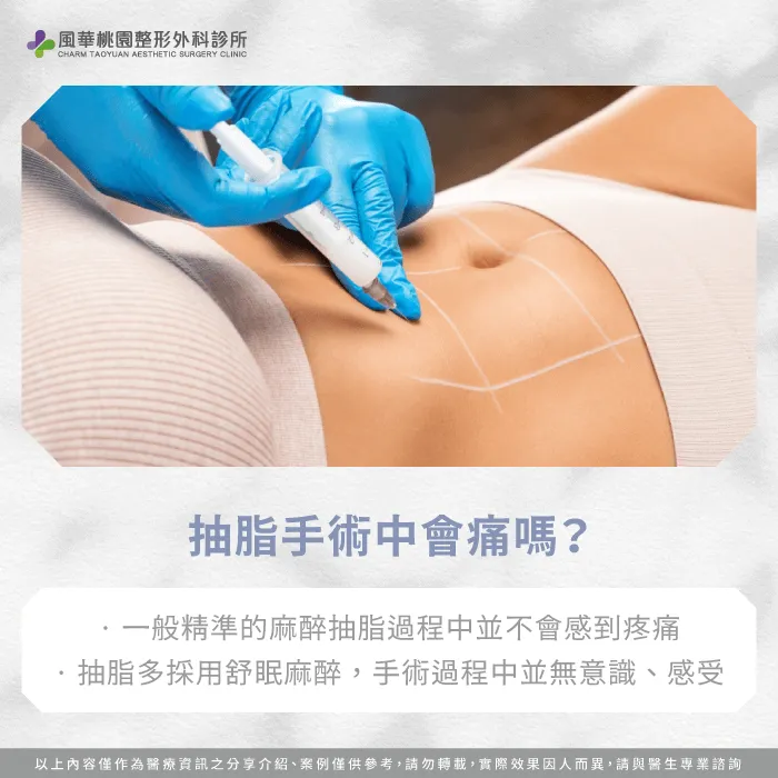 抽脂手術中會痛嗎-抽脂會痛嗎