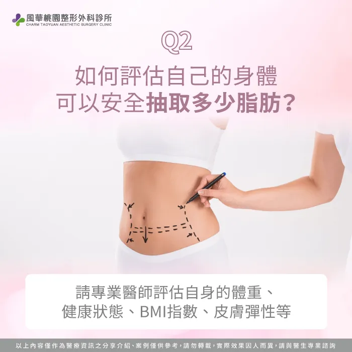 怎麼評估自己要抽多少脂肪-抽脂最多可以抽多少