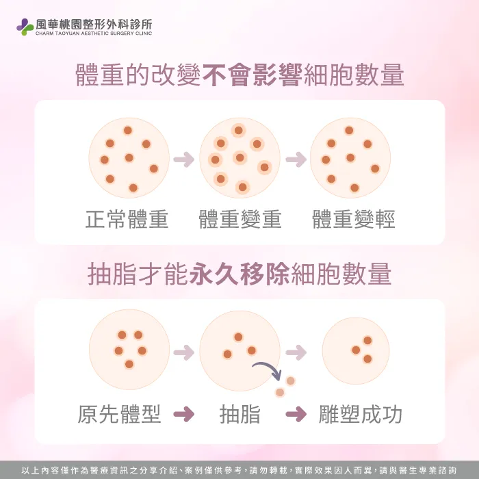 脂肪與減重及抽脂的關係-抽脂最多可以抽多少