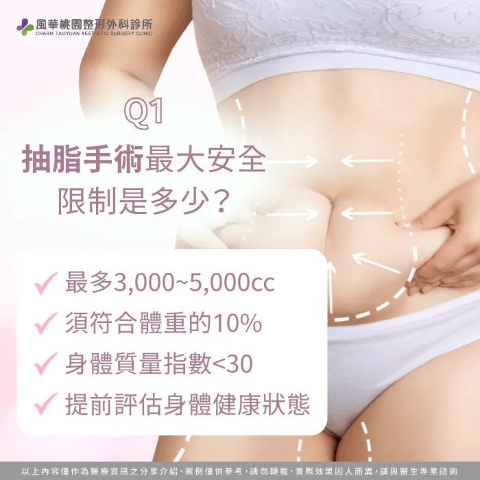 抽脂可以抽多少-抽脂最多可以抽多少