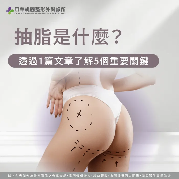 抽脂是什麼-如何抽脂