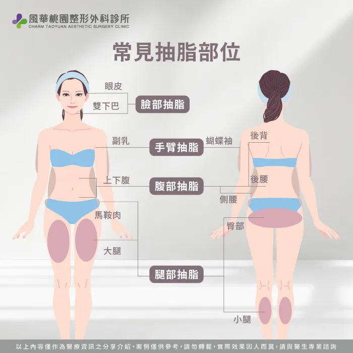 常見抽脂部位-抽脂是什麼