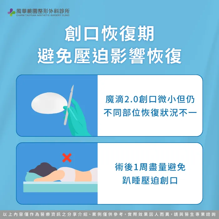 創口恢復期避免壓迫-魔滴隆乳2.0後睡覺姿勢