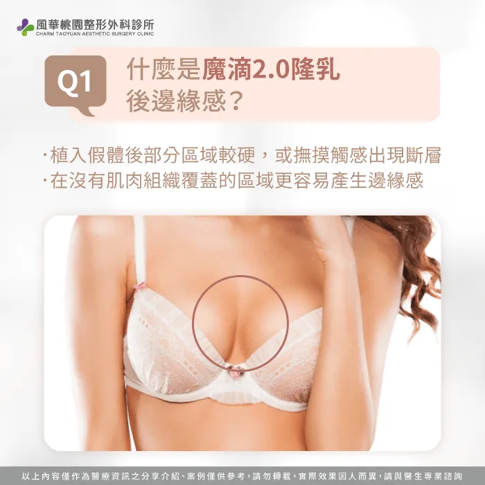 什麼是隆乳後邊緣感-魔滴2.0隆乳後邊緣感