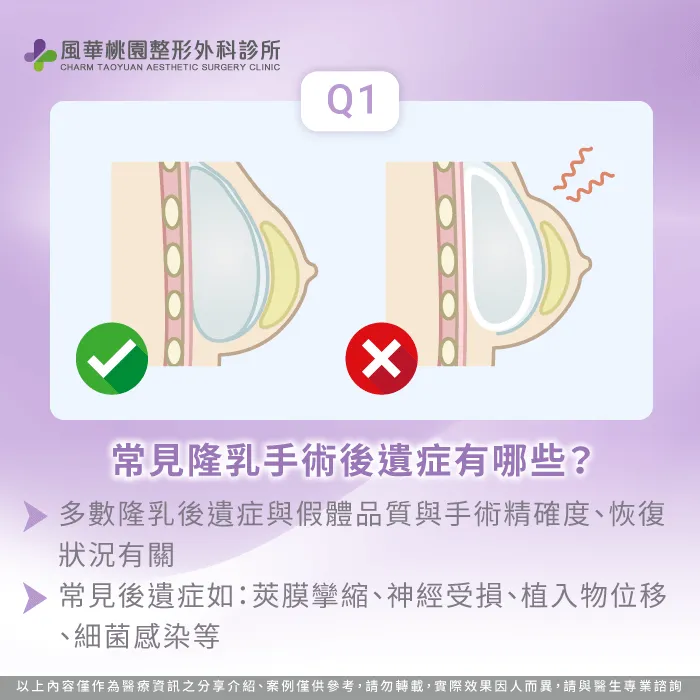 常見隆乳手術後遺症-魔滴2.0隆乳 有後遺症嗎