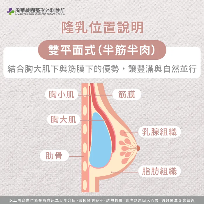 雙平面式-魔滴2.0隆乳放的位置