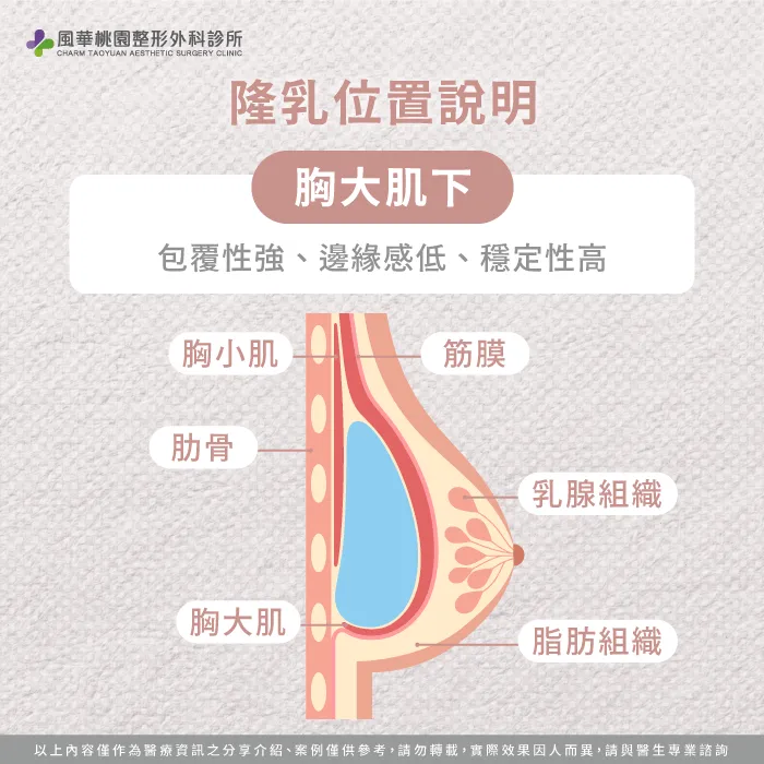 胸大肌下-魔滴2.0隆乳放的位置