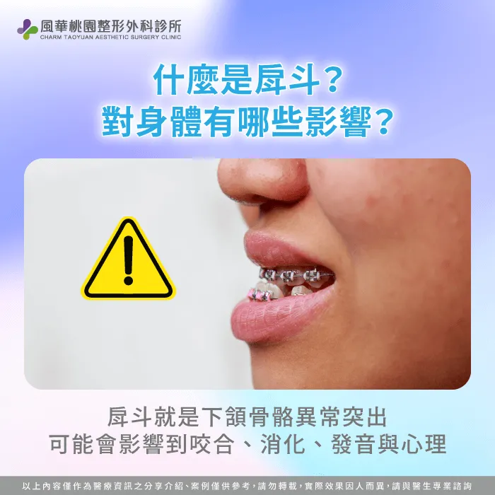 什麼是戽斗-戽斗一定要正顎嗎