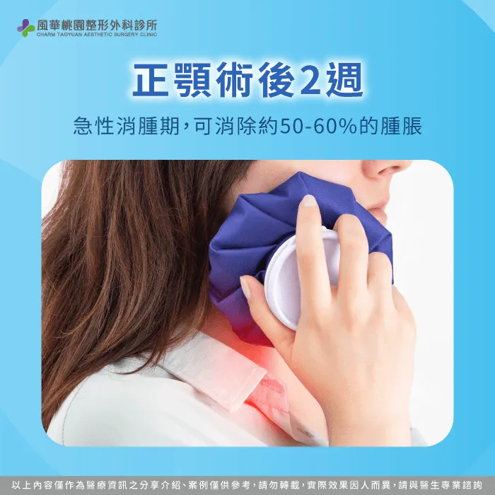 術後2週是急性消腫期 正顎手術消腫時間 -正顎消腫多久