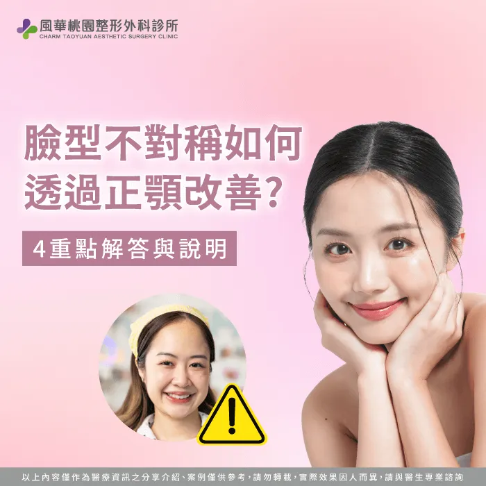 臉型不對稱正顎-臉歪正顎