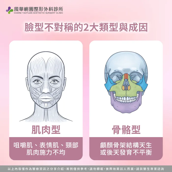 臉型不對稱的類型與原因-臉型不對稱正顎