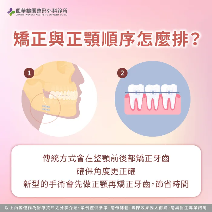 矯正與正顎的順序-正顎一定要矯正嗎