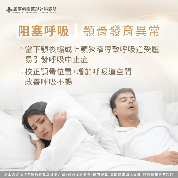 阻塞呼吸-正顎手術必要嗎