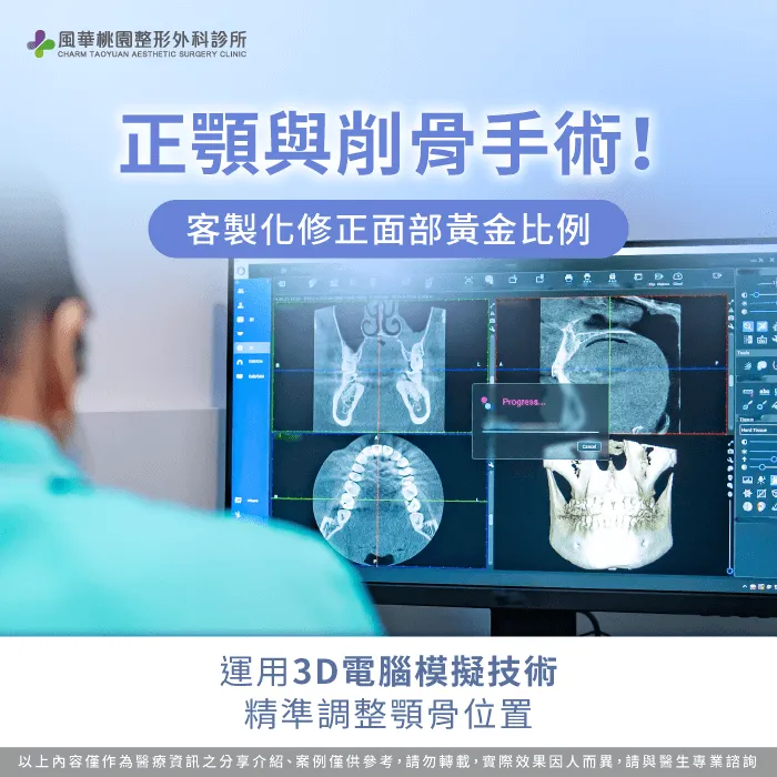 正顎手術與削骨手術對比-臉歪一邊怎麼辦